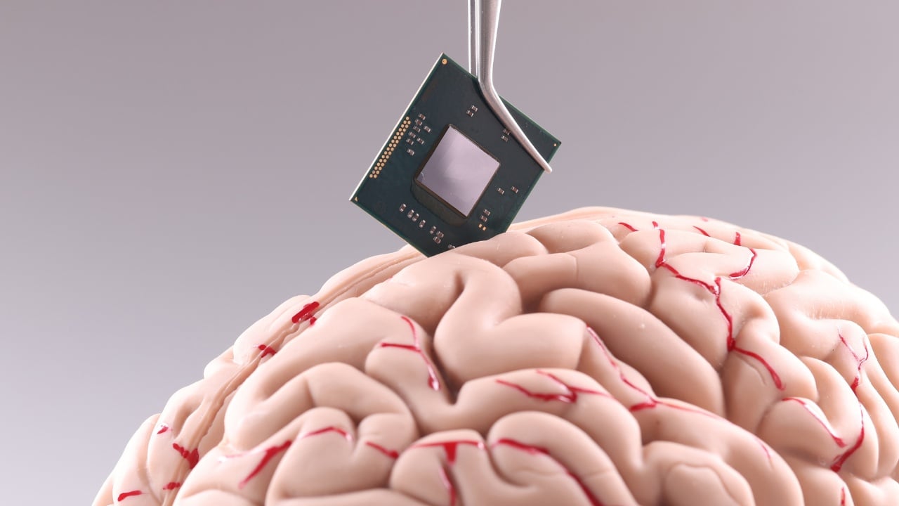 Neuralink's Brain Chip Has Been Approved for Human Trials | EM360