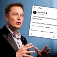 neuralink elon musk
