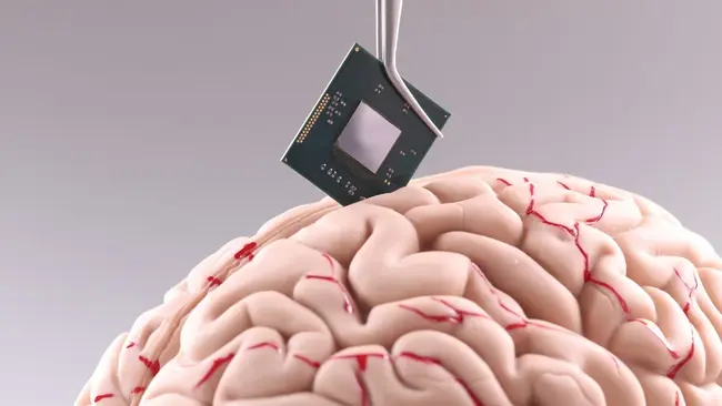 Neuralink